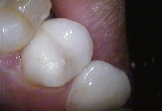 pv-after