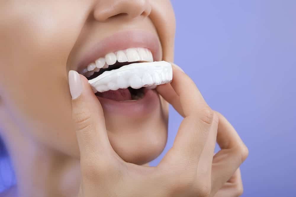 The Dangers of Teeth Whitening Gel - Cosmetic Dentist Los Angeles