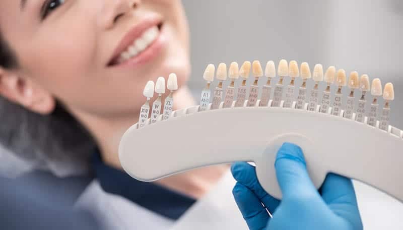 The Worry about How Much do Porcelain Veneers Cost